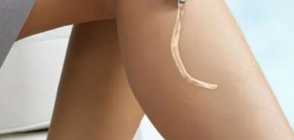 Using Vetonus gel