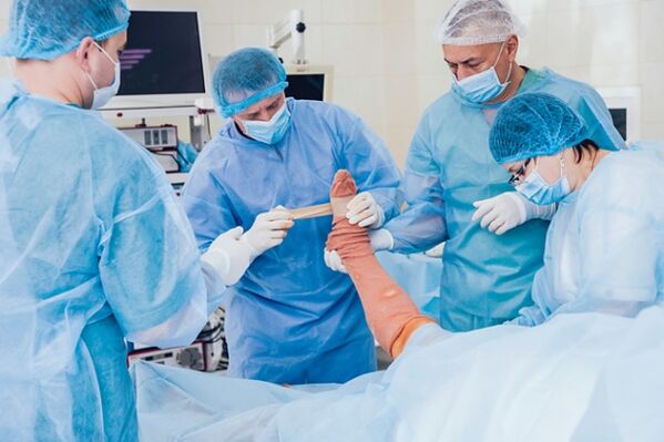 Varicosis surgery