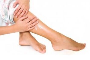 Treatment of varicose veins on the legs with ointment