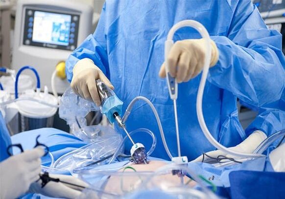 surgical treatment of varicose veins in the pelvic area